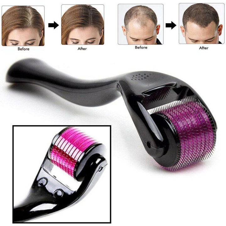 High Quality Derma Roller 0.5 mm Hair & Skin System